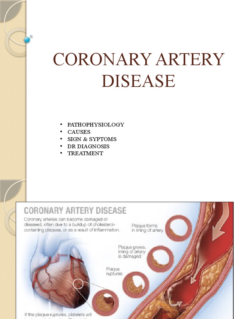 Coronary Artery Disease Overview | PDF | Self-Improvement