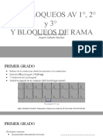 ECG - Bloqueos