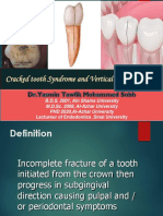Cracked Tooth Syndrome and Vertical Root Fracture 2 1 1