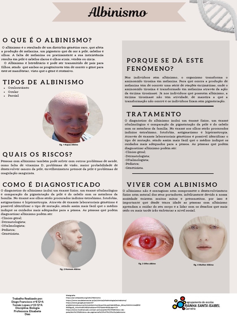Diagnóstico e Tipos de Albinismo | PDF | Medicina Clínica | Doenças e  distúrbios, image size:768x1024