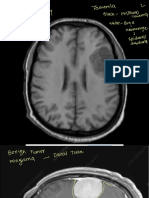 Neurosurgery Images