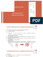 Espondilitis Anquilosante