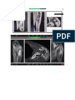 Dermatomiositis Exposicion Casos Clinicos