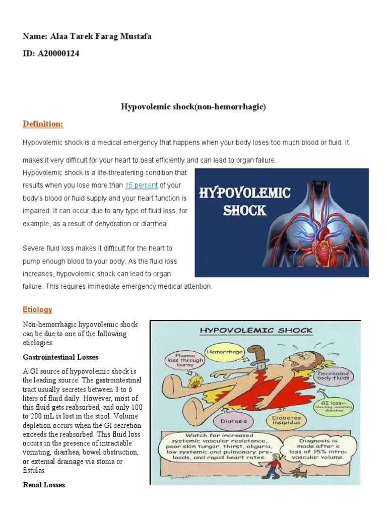 Hypovolemic Shock PDF Shock (Circulatory) Blood Pressure