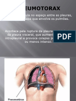 Pneumotorax e Tuberculose