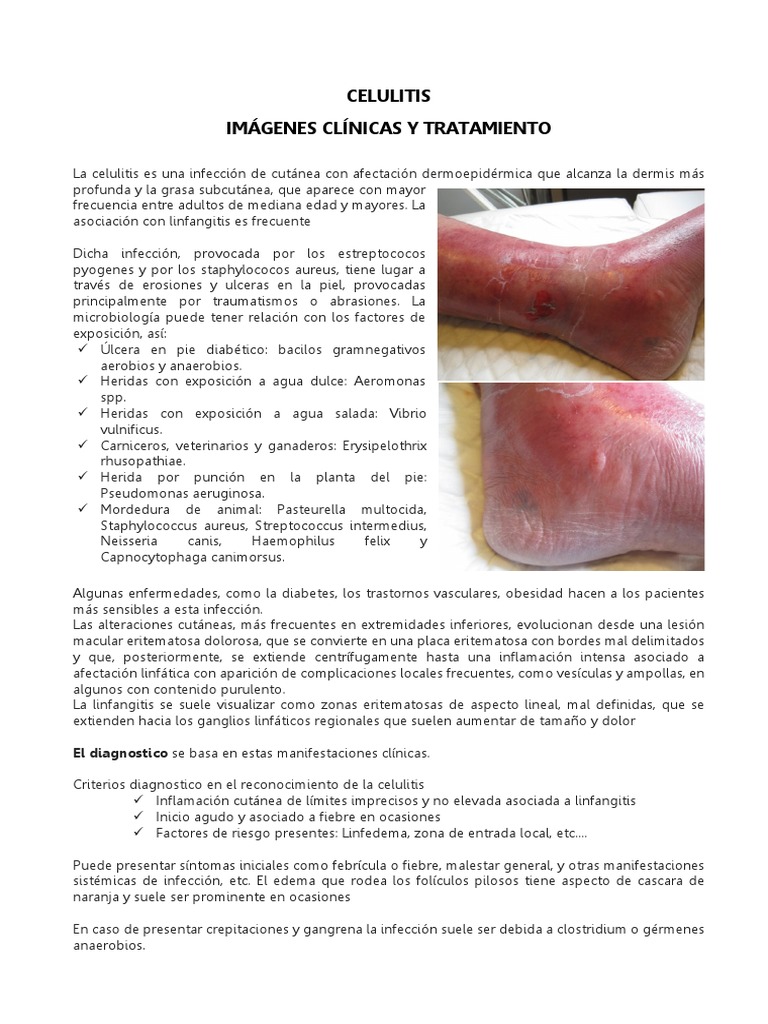 celulitis-imagenes-y-tratamiento-pdf-especialidades-medicas
