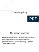 Crown Lengthing