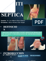 Artritis Septica