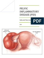 Pelvic Inflammatory Disease (Pid) : Solly and Flory Corporation