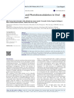 Lasers: High Power Laser and Photobiomodulation in Oral Surgery: Case Report