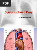 Arch K Signs in Chest Xray 160210003601