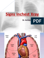 Arch K Signs in Chest Xray 160210003601