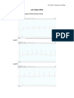 Lab 4 EKG Report