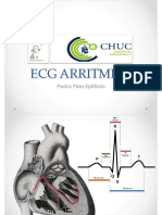 4_ecg_arritmias_pe (6)