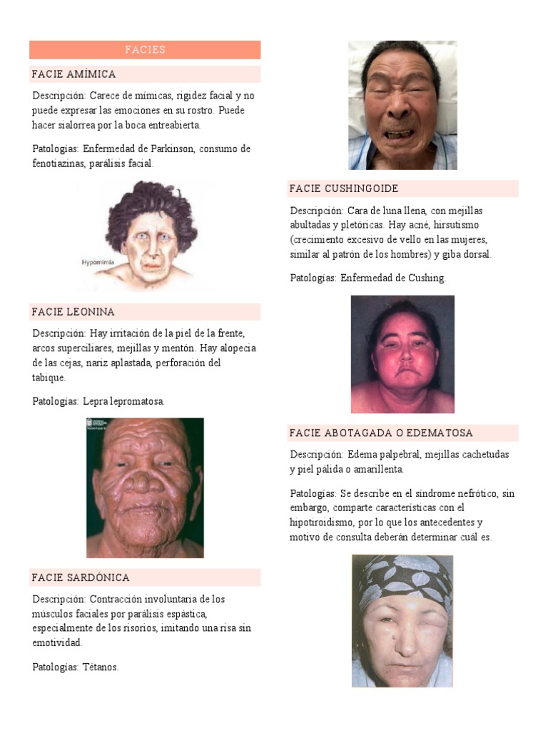 Fácies Adenoideana: Impactos da Adenoide Aumentada, image size:768x1024