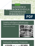 Diagnóstico Radiológico en La Enfermedad Periodontal