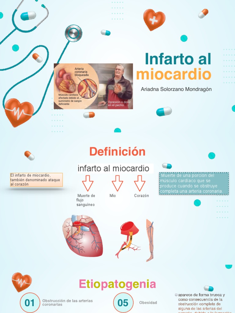 Causas del Infarto de Miocardio | PDF | Infarto de miocardio ...