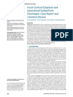 Focal Cortical Dysplasia and Generalized Epileptiform Discharges: Case Report and Literature Review