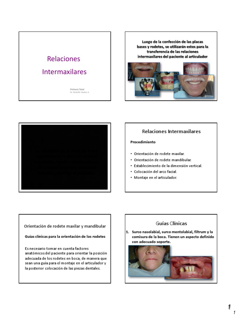 5 Relaciones Intermaxilares | PDF