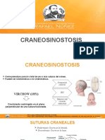 CRANEOSINOSTOSIS