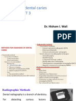 2nd Grade Diagnosis of Dental Caries 3