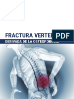 VertebralFractureFactsheet SPANISH