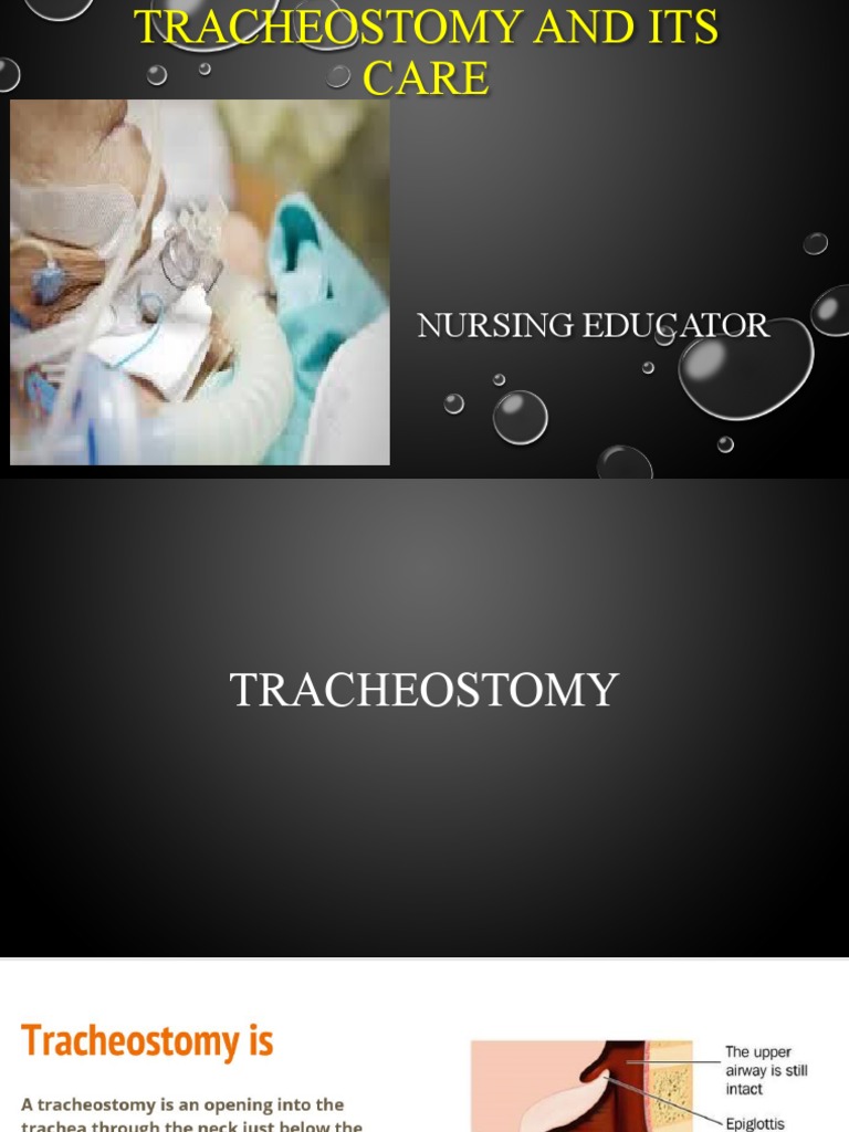 Tracheostomy and Its Care For Nurses PDF