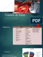 Trauma de tórax