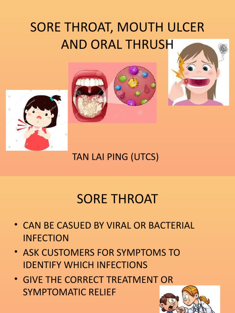 Oral thrush sale on tonsils