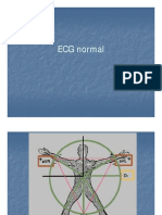 ECG Normal