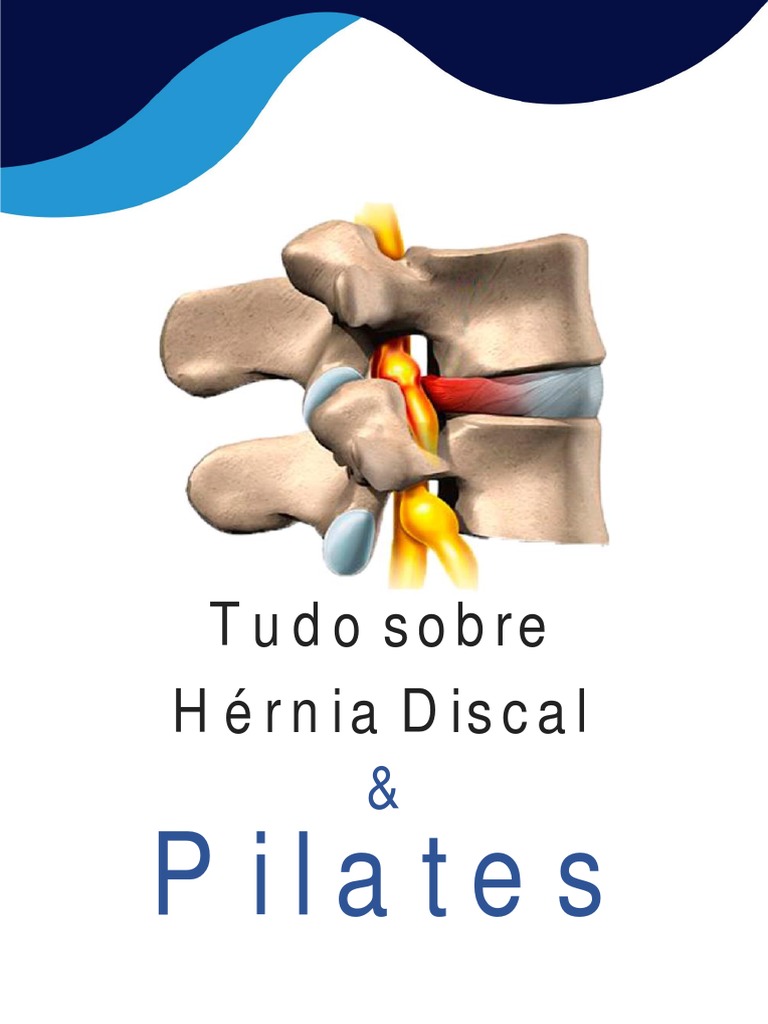 Hérnia Discal e Pilates: Tratamento Eficaz | PDF
