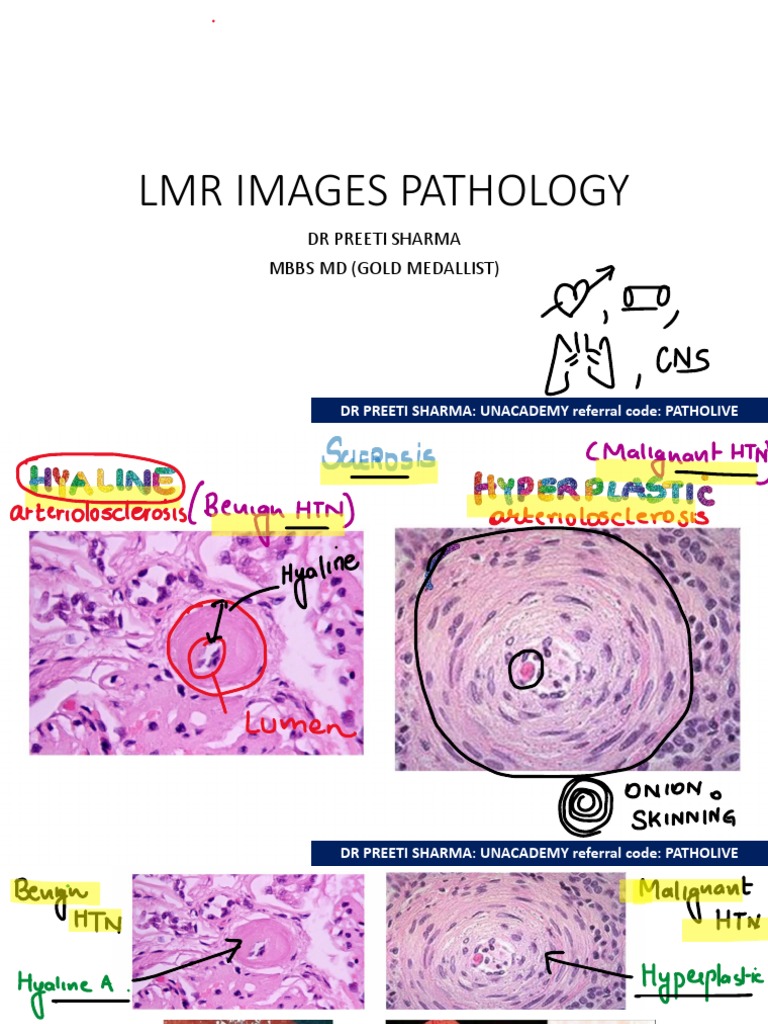 LMR Pathology with Dr. Preeti Sharma | PDF