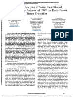 Design and Analysis of Novel Face Shaped Microstrip Array Antenna of UWB For Early Breast Tumor Detection