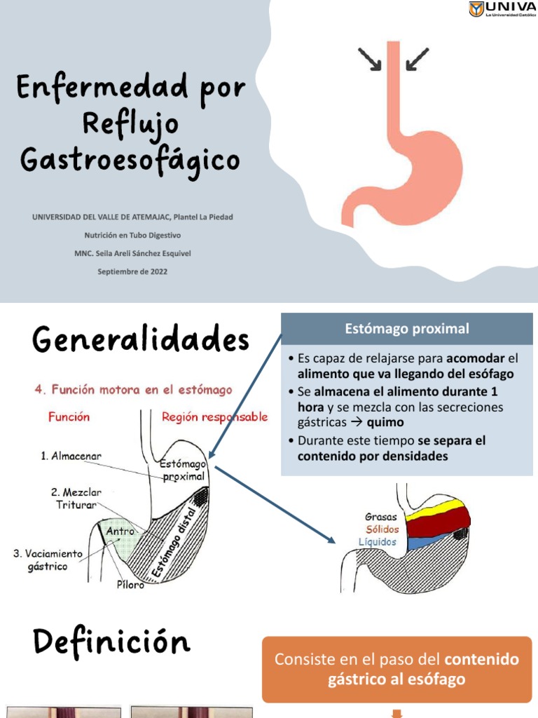 Enfermedad por Reflujo Gastroesofágico: Guía | PDF | La enfermedad por ...