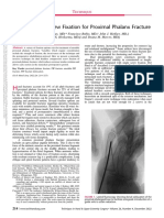 Double Barrel Screw Fixation For Proximal Phalanx.2