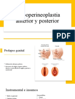 Colpoperineoplastia Anterior y Posterior