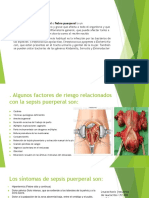 ESEPTISEMIA