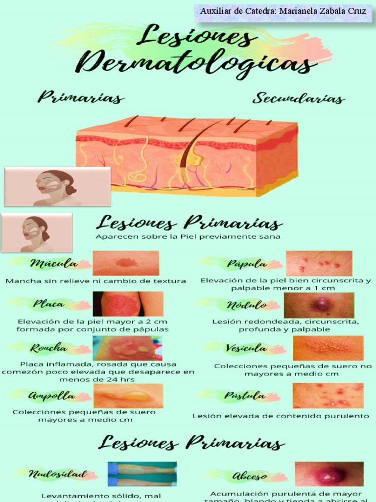 Lesiones Primarias Dermatologia PDF