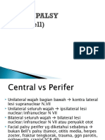Bell's Palsy