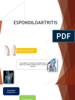 Espondiloartropatias