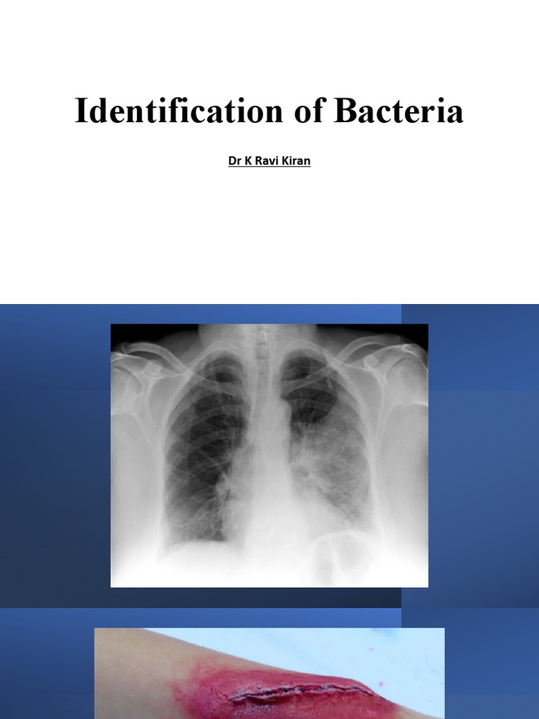 Identification of Bacteria | PDF | Microbiology | Medical Specialties