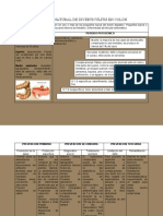 Dietoteria Historia Natural Diverticulitis de Colon