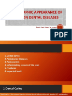 Radiographic Appearance of Common Dental Diseases: Asst. Prof. Sana'a Jamal