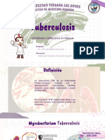 Tuberculosis