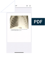 Radiologia Pediatrica Raspuns Var5