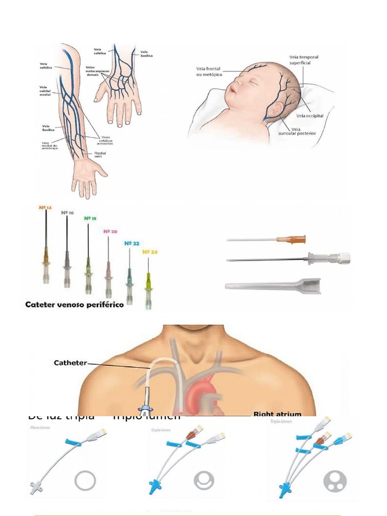 Acesso | PDF