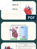 Transposition of The Great Arteries (TGA)