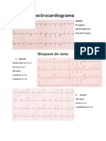 Electrocardiograma Cardio Med 2-1 (1)