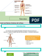 Sarcomas