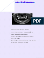 Displasia Cleidocraneal